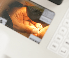 レーザー溶接でワカン閉じ